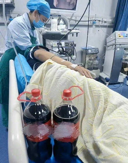 喝可乐治疗胃结石是真的吗?