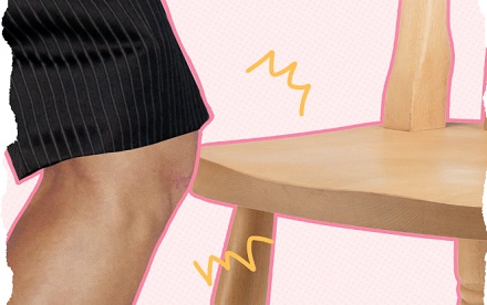为什么女生的身上会经常出现淤青?