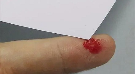 为什么被纸划伤手会特别痛?