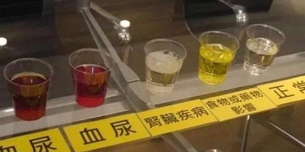 往尿里滴自己血液,可以伪装血尿吗?
