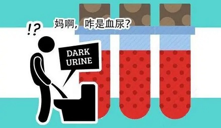往尿里滴自己血液,可以伪装血尿吗?