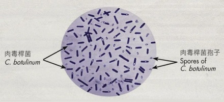 明明 100℃ 就能沸腾,灭菌为什么要 121℃?