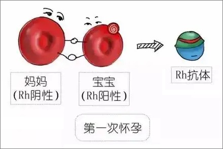 Rh 阴性血的妈妈只能生一个孩子？