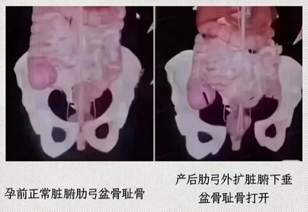 为啥欧美孕妇产后恢复的速度更快一点?