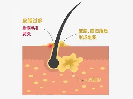 为什么人在广东会变得黄黄的?