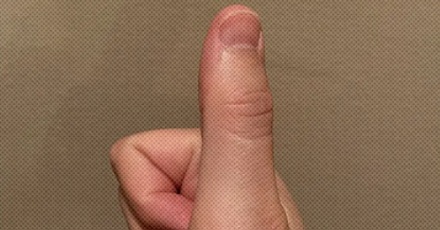 食指无名指都是三节，为什么只有大拇指是两节？
