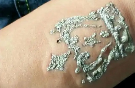 纹身的人更易患皮肤癌淋巴癌?