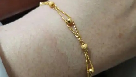 为什么金属过敏的人,只对金子不过敏?