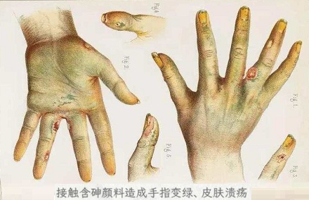为什么游戏中的毒元素通常以绿色作视觉表达?