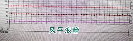 为什么手术室里最怕麻醉医生忽然站起来?