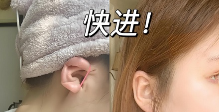 为何明星喜欢在耳朵上绑皮筋？