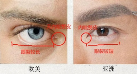 为啥现在欧美人喜欢做「闭眼角手术」？