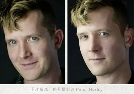 为啥现在欧美人喜欢做「闭眼角手术」？