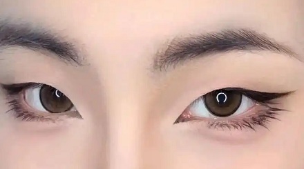 为啥现在欧美人喜欢做「闭眼角手术」？