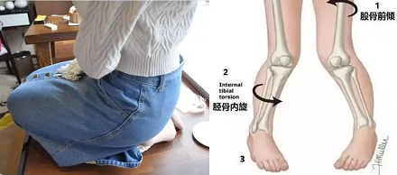 为什么日本女性走内八字的那么多？