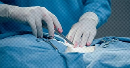 法医解剖「新鲜」尸体时要先放血吗？