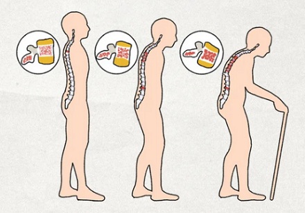 为什么上了年纪的人，总喜欢背着手走路？