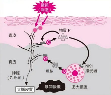 为什么伤口愈合的时候，人会感觉痒痒的？