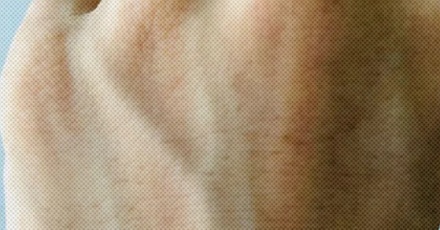 为什么血是红的，血管却看起来是青的？