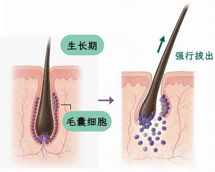 为什么电视剧里做亲子鉴定还非要偷偷拔头发？捡地上的不行吗？