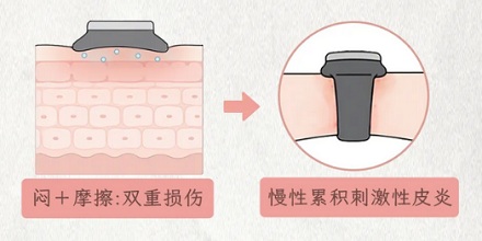 为什么运动手环戴久了，那块皮肤会变得又干又糙？