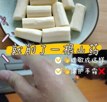 为什么手碰到山药会奇痒无比?