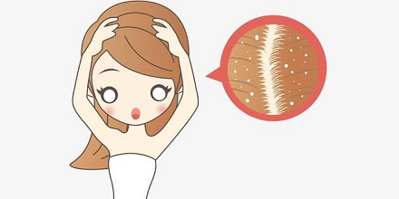 我们不能没有头皮屑?