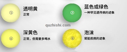 如何从尿液判断健康情况?